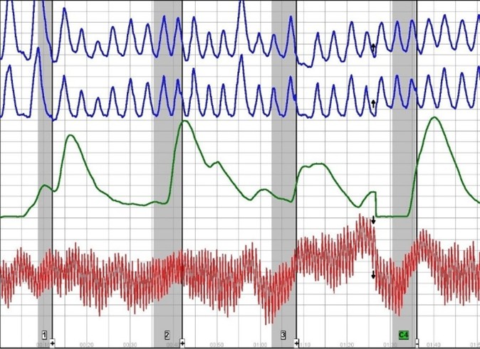 Polygraph6