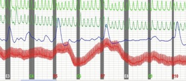 Polygraph7